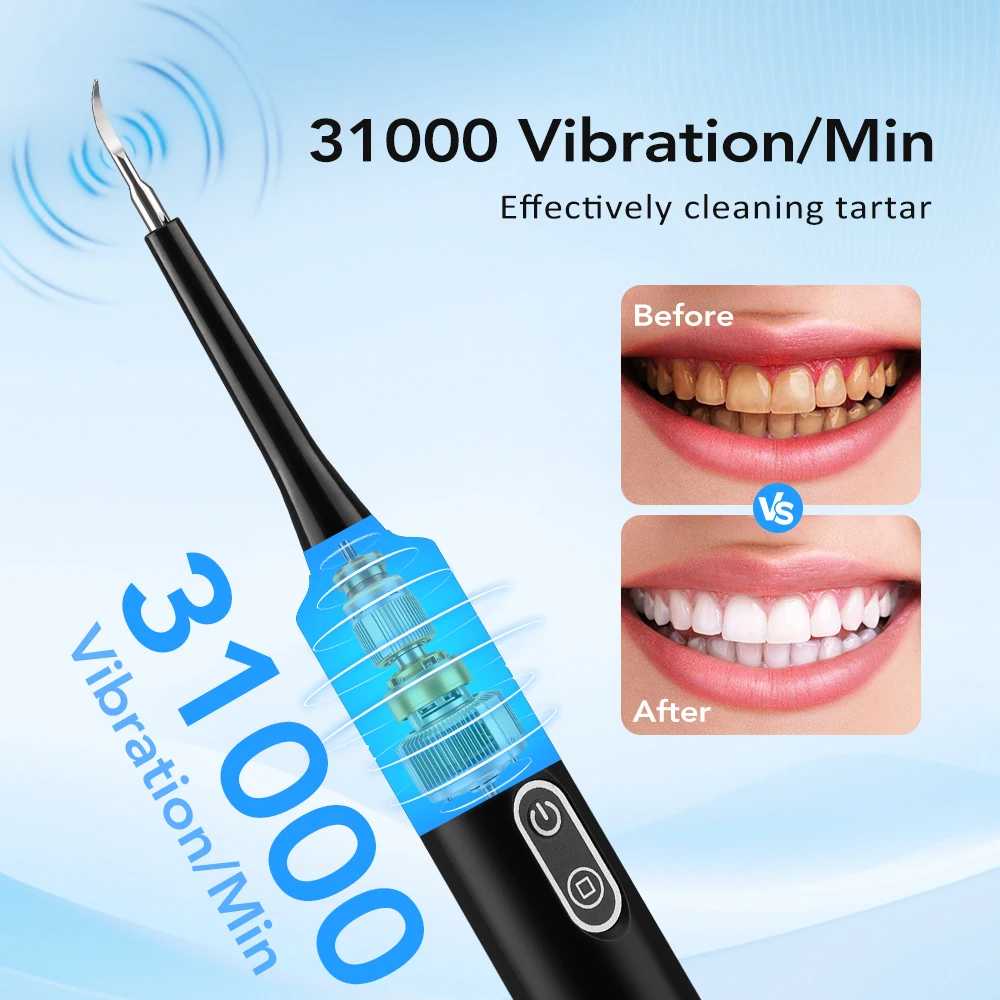 Electric Sonic Vibration Denta - Teeth Whitening Mouthwash ulasan dan harga
